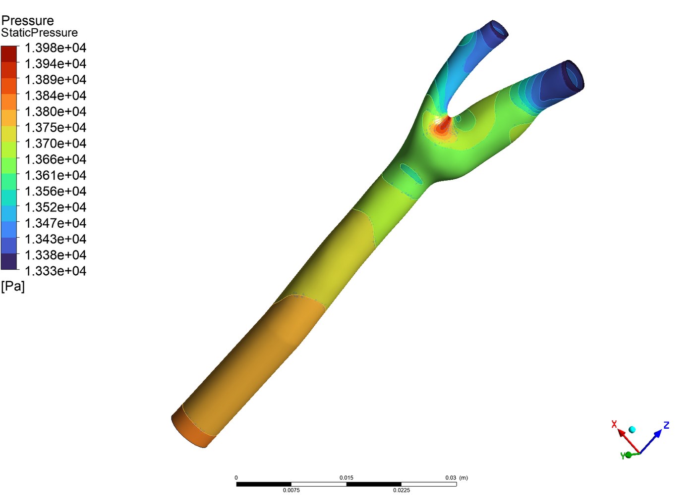 Static pressure contour on the carotid walls at peak systole