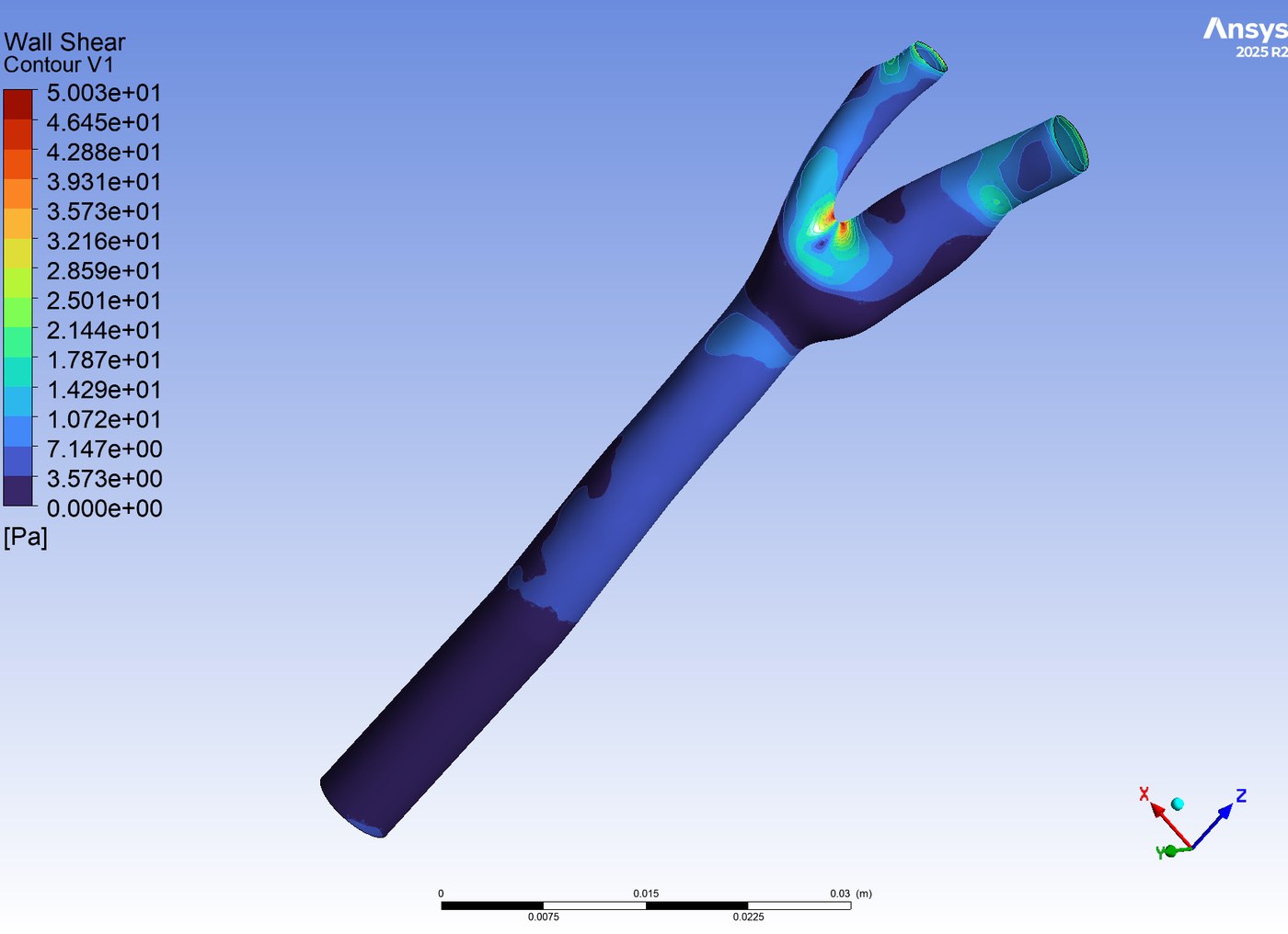 Wall shear stress contour on the carotid walls at peak systole